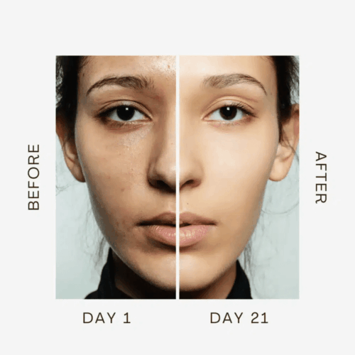 Aurora Skin Facial Sculptor Before and After