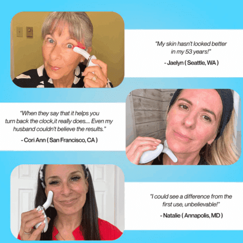 Aurora Skin Facial Sculptor (official Retailer)